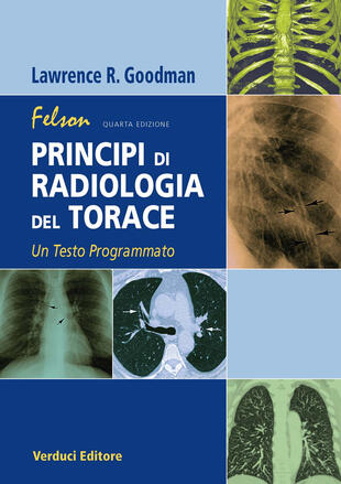 copertina Felson. Principi di radiologia del torace. Un testo programmato