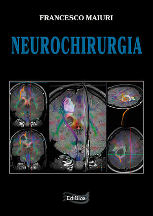 copertina Neurochirurgia